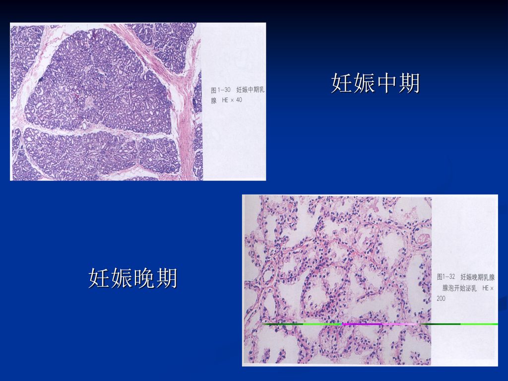 乳腺增生病 张掖博爱医院.